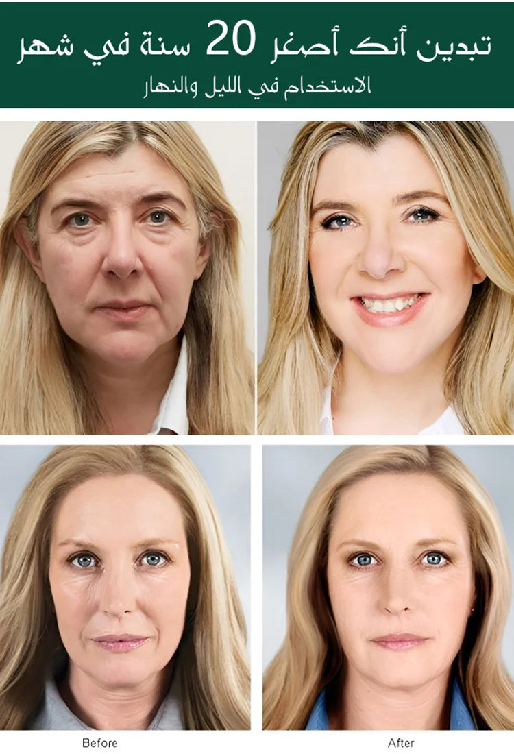 قناع الوجه لرفع بشرة الوجه المضاد للجاذبية أحدث قناع تم تطويره ضد الشيخوخة والتجاعيد✅